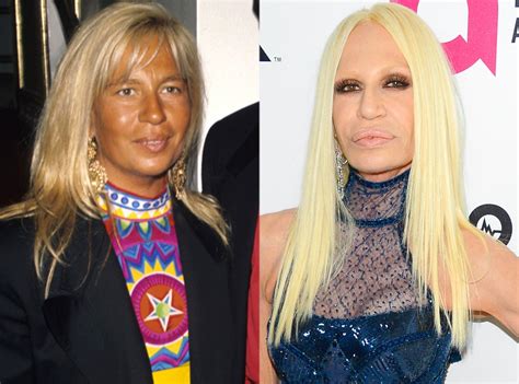 donatella versace face|donatella versace vorher nachher.